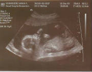 18weeks2days.jpg