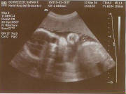 29weeksand6days.jpg