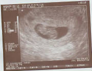 9weeks3days.jpg